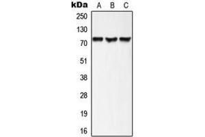 Western blot analysis of AKAP10 expression in HepG2 (A), mouse heart (B), rat heart (C) whole cell lysates. (AKAP10 anticorps  (N-Term))