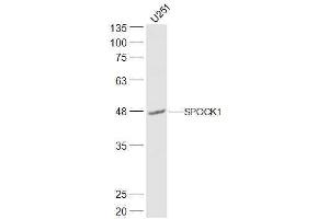 U251 lysates probed with SPOCK1 Polyclonal Antibody, Unconjugated  at 1:500 dilution and 4˚C overnight incubation. (SPOCK1 anticorps  (AA 51-150))
