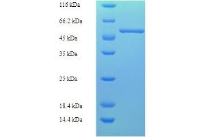 SDS-PAGE (SDS) image for ATPase, H+ Transporting, Lysosomal Accessory Protein 2 (ATP6AP2) (AA 17-350) protein (His-SUMO Tag) (ABIN5709109)