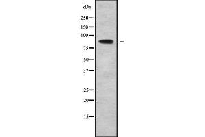 Western blot analysis of PLA2G4B using K562 whole cell lysates