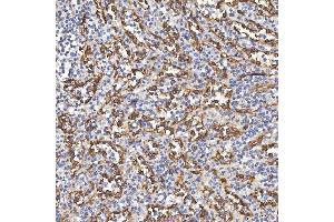 IHC analysis of TP53I13 using anti-TP53I13 antibody (ABIN7601220). (TP53I13 anticorps  (AA 30-365))