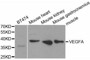 Western blot analysis of extracts of various cell lines, using VEGFA antibody (ABIN5973338) at 1/1000 dilution. (VEGFA anticorps)