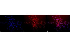 Immunocytochemistry/Immunofluorescence analysis using Rabbit Anti-SOD (Mn) Polyclonal Antibody (ABIN361655 and ABIN361656). (SOD2 anticorps)
