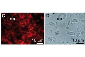 anti-Lectin, Galactoside-Binding, Soluble, 2 (LGALS2) antibody