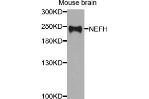 Western blot analysis of extracts of mouse brain, using NEFH antibody (ABIN5974903) at 1/1000 dilution. (NEFH anticorps)