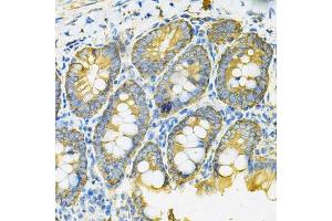 Immunohistochemistry of paraffin-embedded rat intestine using HSP90AB1 Antibody.