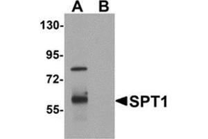 Western blot analysis of VASH1 in human brain tissue lysate with VASH1 antibody at 1 μg/ml in (A) the absence and (B) the presence of blocking peptide. (VASH1 anticorps  (C-Term))
