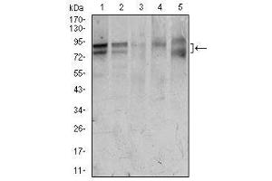 Image no. 4 for anti-Forkhead Box P1 (FOXP1) antibody (ABIN1491561) (FOXP1 anticorps)