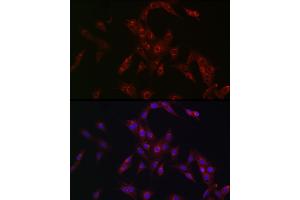 Immunofluorescence analysis of PC-12 cells using MR1 Rabbit pAb (ABIN6131925, ABIN6143983, ABIN6143984 and ABIN6224070) at dilution of 1:100 (40x lens). (MR1 anticorps  (AA 20-260))