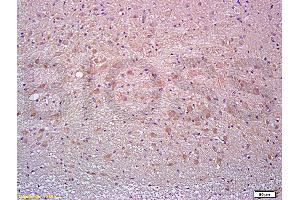 Formalin-fixed and paraffin embedded rat brain tissue labeled with Anti-Thy-1/CD90/ Thy1. (CD90 anticorps  (AA 31-120))
