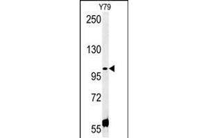 Western blot analysis in Y79 cell line lysates (35ug/lane). (CCDC146 anticorps  (N-Term))