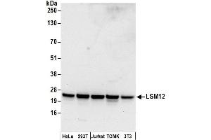 anti-LSM12 Homolog B (LSM12B) (AA 1-50) antibody