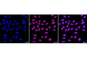 Immunocytochemical staining of Hela cells with PABPN1 antibody (ABIN7797755), 1:1,000).