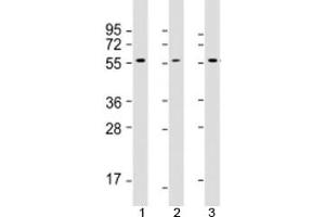 Western blot testing of 1) human MCF7, 2) human Jurkat and 3) rat PC-12 cell lysate with AKT2 antibody at 1:2000. (AKT2 anticorps  (AA 272-481))