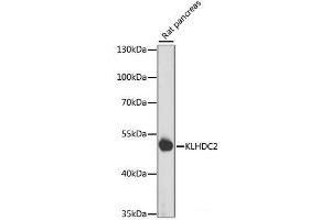 Western blot analysis of extracts of Rat pancreas using KLHDC2 Polyclonal Antibody at dilution of 1:1000. (KLHDC2 anticorps)