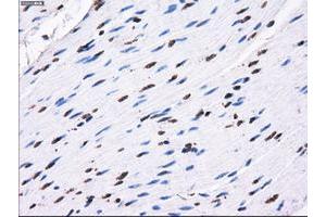 anti-Replication Protein A2, 32kDa (RPA2) antibody