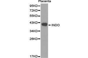 Western Blotting (WB) image for anti-Indoleamine 2,3-Dioxygenase 1 (IDO1) antibody (ABIN1873231) (IDO1 anticorps)