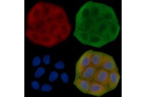 ABIN7095684 and ABIN7099746 staining Hela cells(30 min of UV treatment) by IF/ICC. (KLHL26 anticorps)