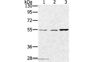 Western blot analysis of Lovo, hela and SKOV3 cell, using SESN2 Polyclonal Antibody at dilution of 1:300