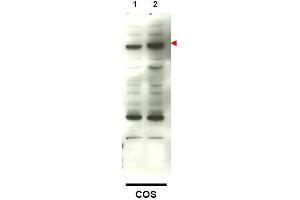 Image no. 1 for anti-SMAD Family Member 4 (SMAD4) (C-Term) antibody (ABIN401410) (SMAD4 anticorps  (C-Term))