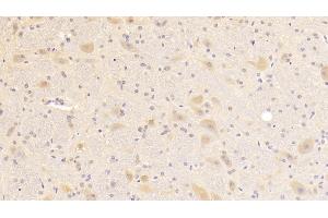 Detection of PCT in Rat Cerebrum Tissue using Polyclonal Antibody to Procalcitonin (PCT) (Procalcitonin anticorps  (AA 26-136))