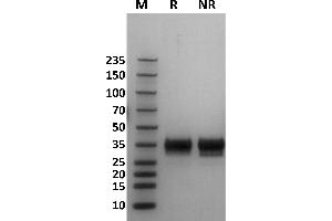 Human Fc gamma RIIb / CD32b protein on Coomassie Blue stained SDS-PAGE under non-reducing (NR) and reducing (R) conditions.