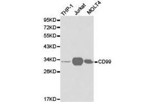 Western Blotting (WB) image for anti-CD99 (CD99) antibody (ABIN1871666) (CD99 anticorps)