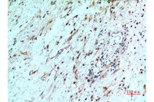 Immunohistochemistry (IHC) analysis of paraffin-embedded Human Brain, antibody was diluted at 1:100.