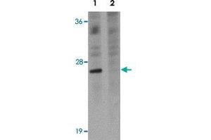 Western blot analysis of EL4 cells with TSPAN9 polyclonal antibody  at 1 ug/mL in (Lane 1) the absence and (Lane 2) the presence of blocking peptide. (Tetraspanin 9 anticorps)
