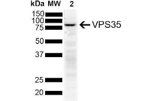 Western Blot analysis of Human SH-SY5Y showing detection of VPS35 protein using Mouse Anti-VPS35 Monoclonal Antibody, Clone 11H10 (ABIN6933006).