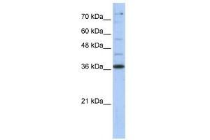 GAPDH antibody used at 1 ug/ml to detect target protein. (GAPDH anticorps  (Middle Region))