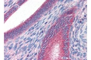 anti-DNA-Damage Regulated Autophagy Modulator 1 (DRAM1) (C-Term) antibody