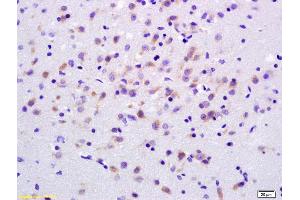 Formalin-fixed and paraffin embedded rat brain labeled with Anti-ADCY7 Polyclonal Antibody, Unconjugated (ABIN751213) at 1:200 followed by conjugation to the secondary antibody and DAB staining.