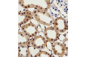 Immunohistochemical analysis of paraffin-embedded R. (CSNK2A1/CK II alpha anticorps  (AA 250-284))