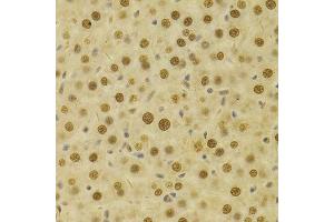 Immunohistochemistry of paraffin-embedded rat liver using HDGF Antibody. (HDGF anticorps  (AA 1-240))