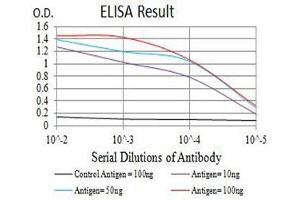Black line: Control Antigen (100 ng),Purple line: Antigen (10 ng), Blue line: Antigen (50 ng), Red line:Antigen (100 ng)