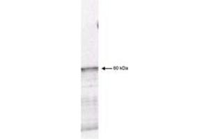 Image no. 1 for anti-3-phosphoinositide Dependent Protein Kinase-1 (PDPK1) (AA 301-312) antibody (ABIN199938) (PDPK1 anticorps  (AA 301-312))