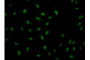 Immunofluorescence staining of Hela Cells with ABIN7127571 at 1:50, counter-stained with DAPI. (Recombinant Interleukin enhancer-binding factor 3 (ILF3) anticorps)