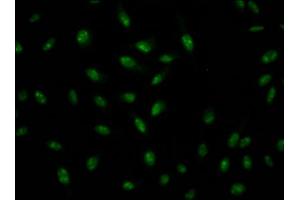 Immunofluorescence staining of Hela Cells with ABIN7127571 at 1:50, counter-stained with DAPI. (Recombinant Interleukin enhancer-binding factor 3 (ILF3) anticorps)