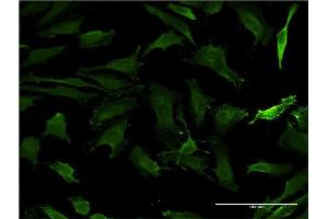 Immunofluorescence of monoclonal antibody to HTT on HeLa cell. (Huntingtin anticorps  (AA 1524-1627))