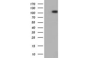Western Blotting (WB) image for anti-Protein Kinase D2 (PKD2) antibody (ABIN1500412) (PKD2 anticorps)