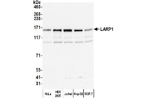 Western Blotting (WB) image for anti-La Ribonucleoprotein Domain Family, Member 1 (LARP1) (AA 275-325) antibody (ABIN7453885)