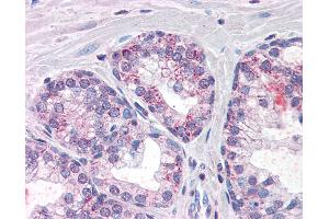 Anti-PDE11A antibody IHC of human prostate. (PDE11A anticorps  (AA 455-468))