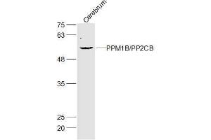 Mouse cerebrum lysates probed with Gliomedin Polyclonal Antibody, Unconjugated  at 1:300 dilution and 4˚C overnight incubation.
