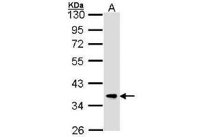 FBXL12 anticorps  (C-Term)