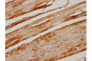 IHC image of ABIN7140219 diluted at 1:300 and staining in paraffin-embedded human skeletal muscle tissue performed on a Leica BondTM system.