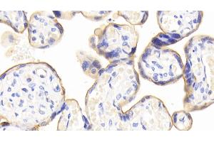 Detection of CD73 in Human Placenta Tissue using Polyclonal Antibody to Cluster Of Differentiation 73 (CD73)