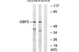 Western blot analysis of extracts from HT-29/COLO cells, using GBP3 Antibody.