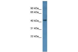 WB Suggested Anti-MAGEA11 Antibody Titration: 0.