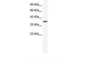 Image no. 1 for anti-Annexin A3 (ANXA3) (C-Term) antibody (ABIN202242) (Annexin A3 anticorps  (C-Term))
